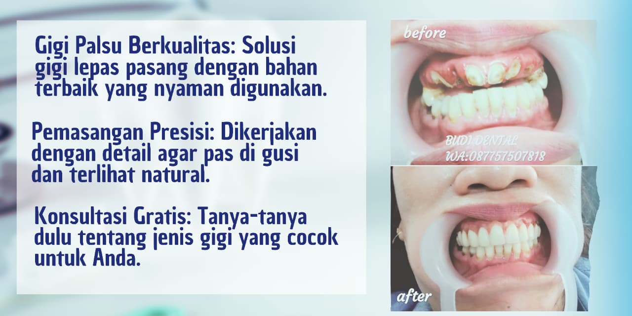 corousel-4