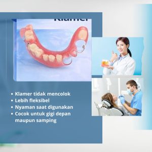 gigi-palsu-hc-artikel