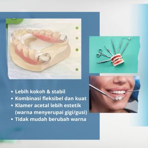 nylon-kombinasi-artikel
